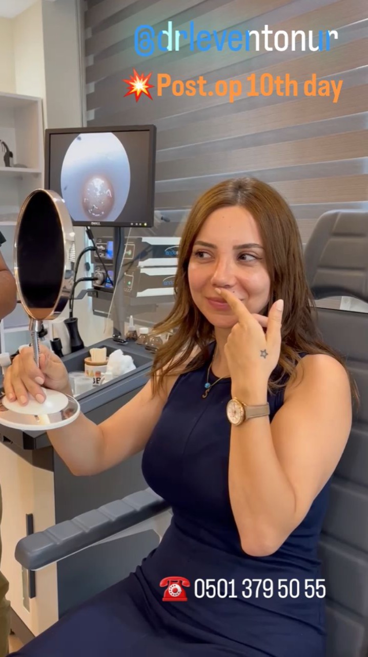 10. Gün: Atelin Çıkarılması — Instagram video kapağı
